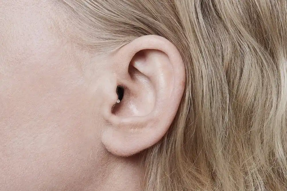 Invisible Hearing Aid